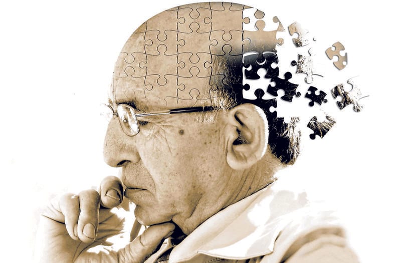 Alzheimer chưa có cách chữa dứt điểm